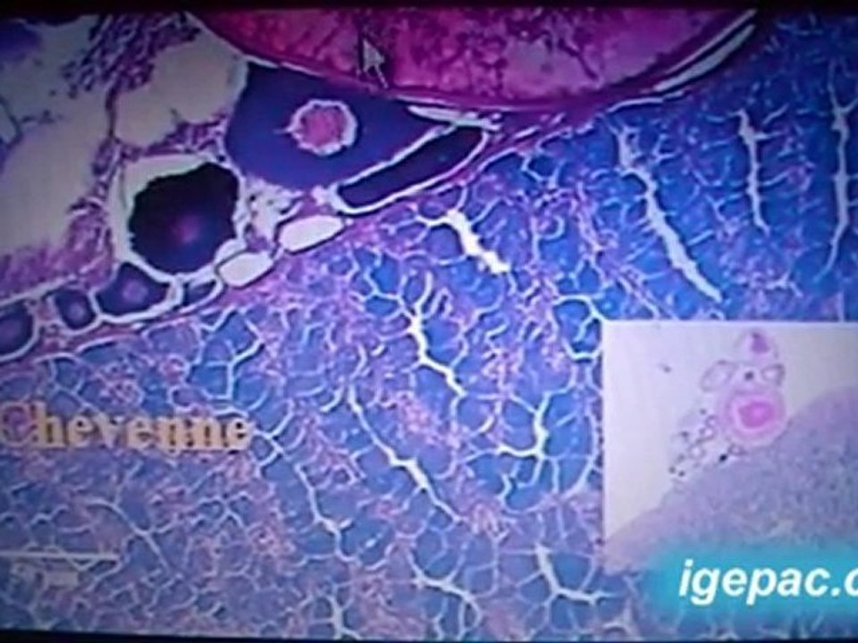 Du poison dans l'eau : les médicaments – France 3 – 2010