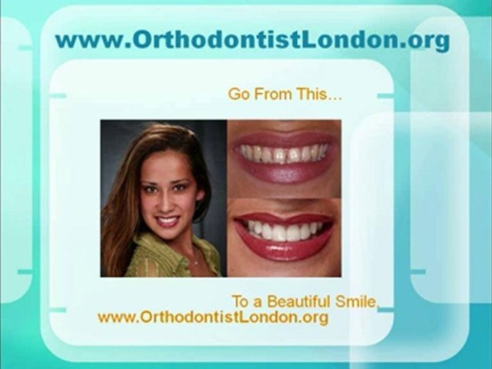 Central London Orthodontist