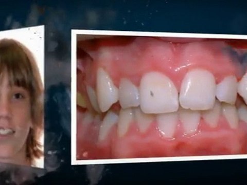 Orthodontist Greeley: Smiles From The Smile Specialist