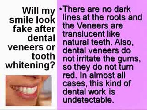 Cosmetic Dentist Smile Teeth Whitening Rockland County NY
