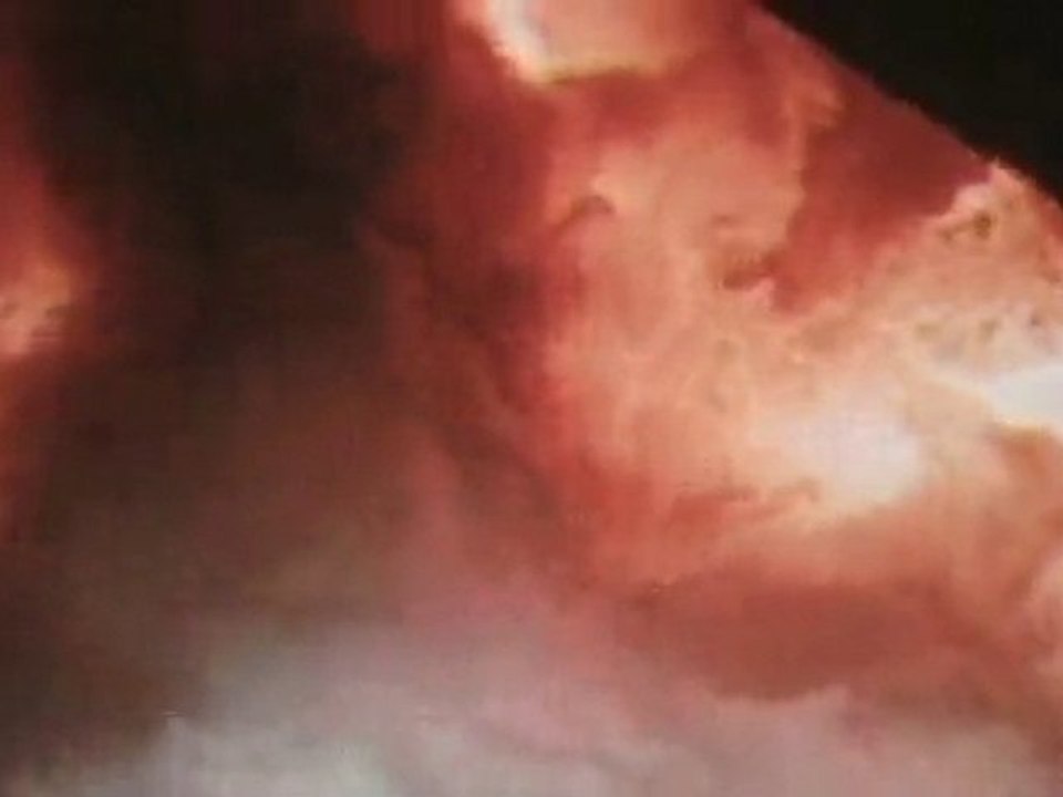 12012   - THE PAIN OF CATASTROPHE PV