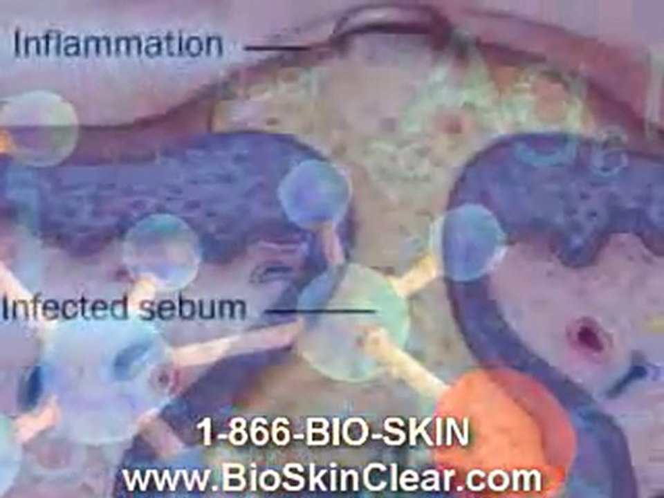 03-www.bioskinclear.com_short