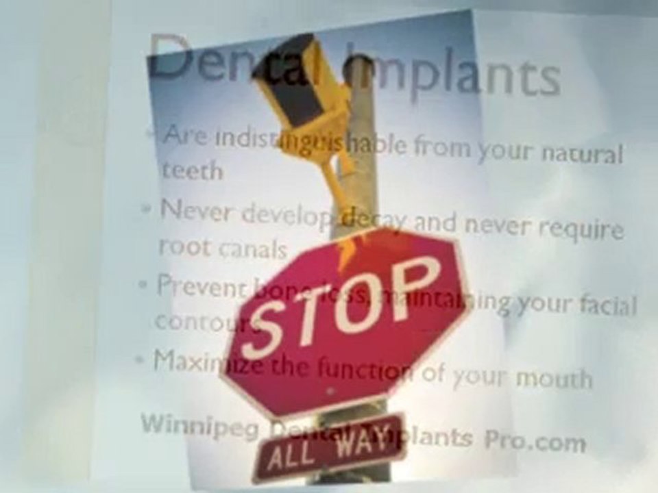 Questions To Ask Before You Get New Dental Implants Winnipeg