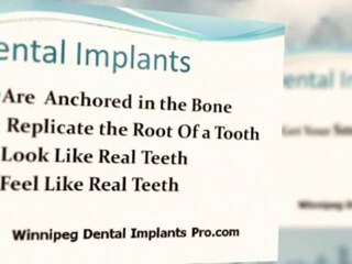 New Dental Implants Procedure Now in Winnipeg Teeth in a Day