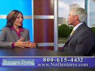 All On 4 Dental Implants Houston Restoring Teeth In A Day