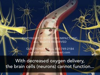 Fetal Effects of Cord Prolapse