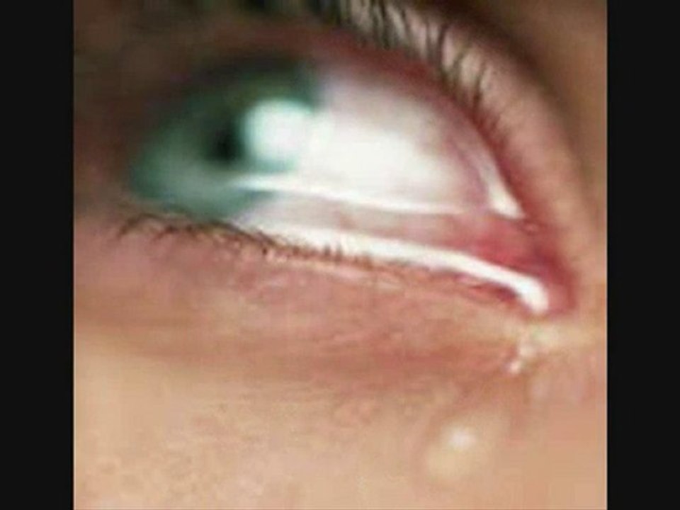 "BIR AŞKI SOLDURMAK (2) YAZAN VE SESLENDİREN: SAVAŞ ŞENEL