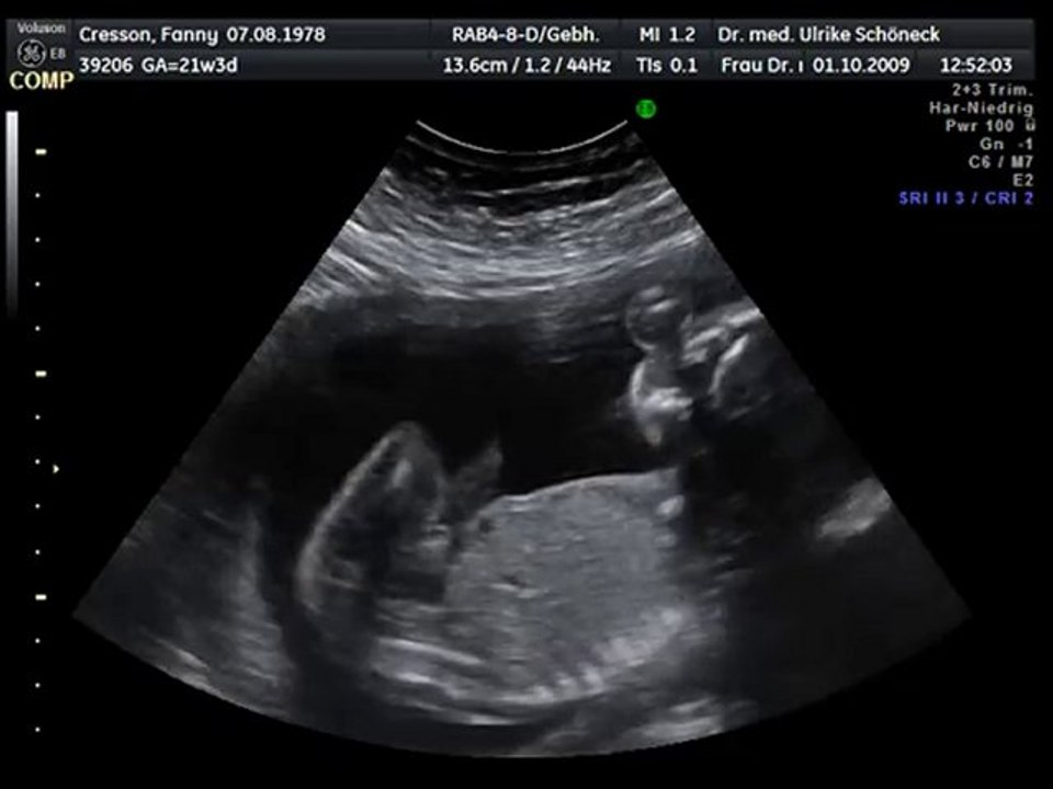 Louise 1° octobre 2009