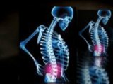 Tucson Chiropractic - Don't Get a Chiropractic Adjustment If