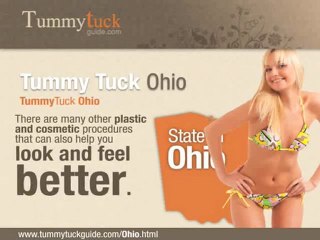 Tummy Tuck Ohio