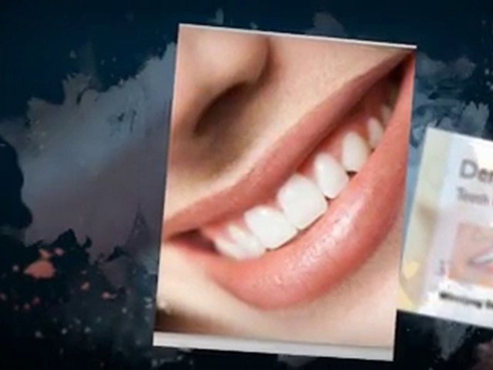 New Winnipeg Dental Implant Facts and Cost Information