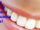 Teeth Whitening Sherman Oaks Teeth Whitening – Valley Den