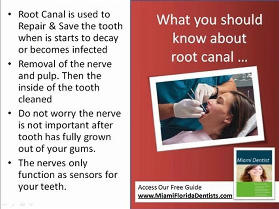 Miami Root Canal Miami FL, Root Canal in Miami FL