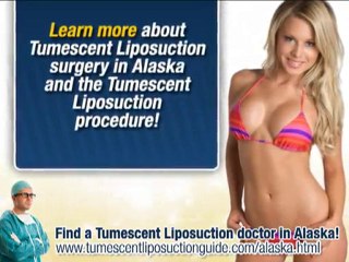 Tumescent Liposuction Alaska