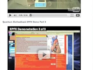 FOR SALE: Quantum Biofeedback SCIO EPFX system