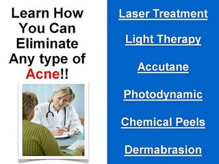 Sherman Oaks Acne Treatment
