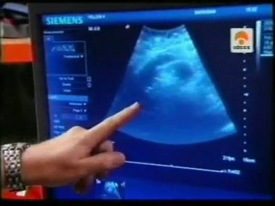 Sopas para adelgazar: La dieta de la sopa