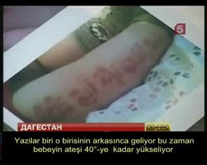 bebegin bedeninde Kuran'dan ayetler