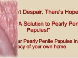 Pearly Penile Papules Removal -How to Remove Papules At Home