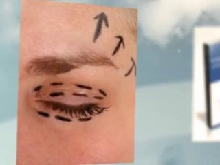 Cosmetic Surgery in Sydney Basics