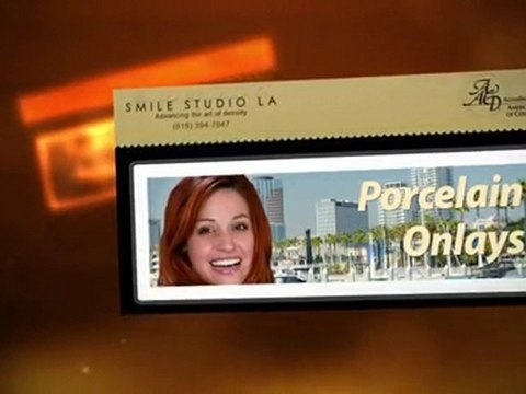 Los Angeles Dental Fillings Beverly Hills - Smile Studio LA