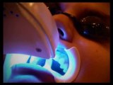 Teeth Whitening Oxford treatments by Oxford Dentists