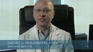Removing unwanted age spots or brown spots with Dr. Goldberg