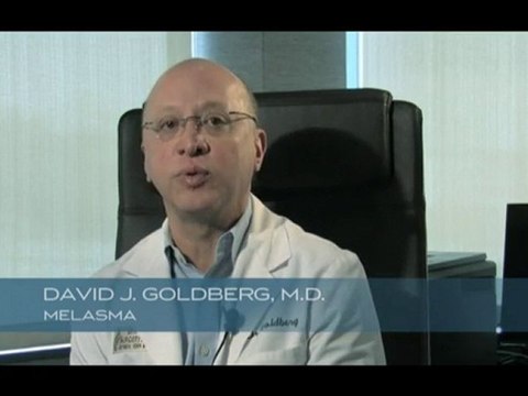 Dr. Goldberg discusses Melasma and treatments options