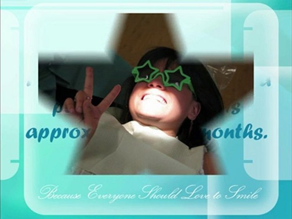 Beach Braces – How Long will it take to Complete ...