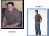 Weight Loss Surgery Dallas-Choosing the Best Dallas Weight