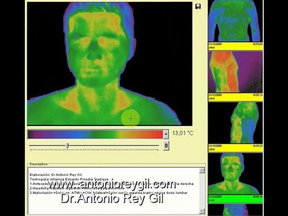 IR. Imagen Infrarroja.Imagen Infravermelha.Termographic