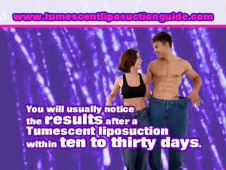 Tumescent Liposuction