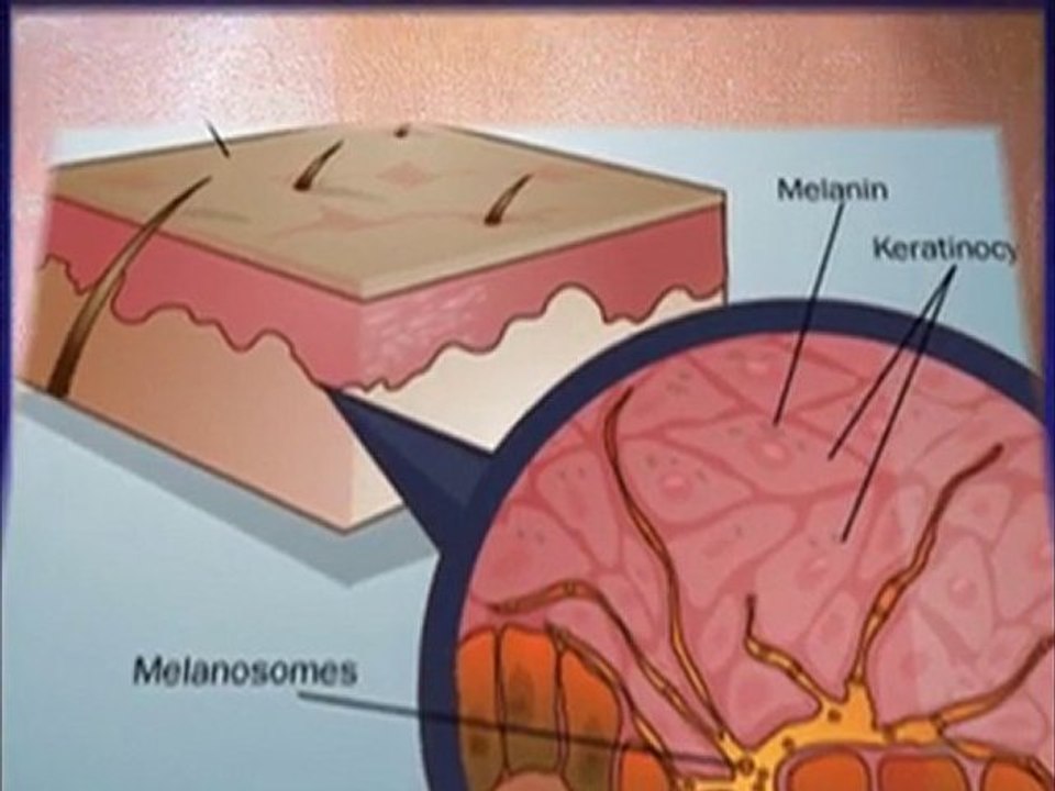 Vanicream Sunscreen, Sensitive Skin, SPF 60 4 oz (113 ...