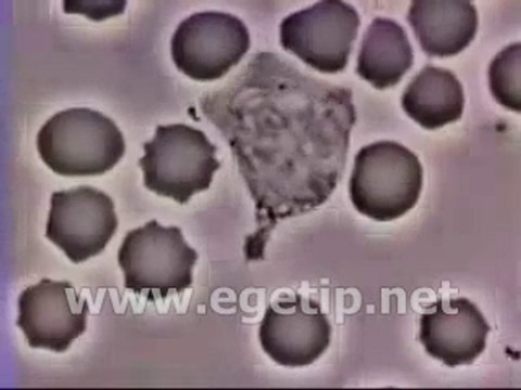 Forum Ege Tıp - Lökosit Bakteriyi Kovalıyor