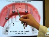 Lowry Denver dentist shows dental implants replace dentures