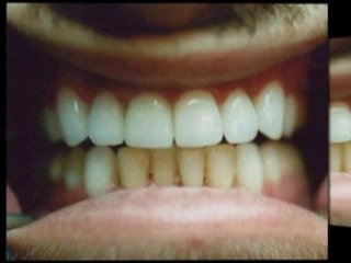 Best Woodland Hills Dentist