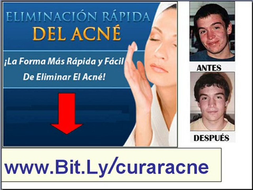 Descubre Como eliminar el acne - Como quitar el acne