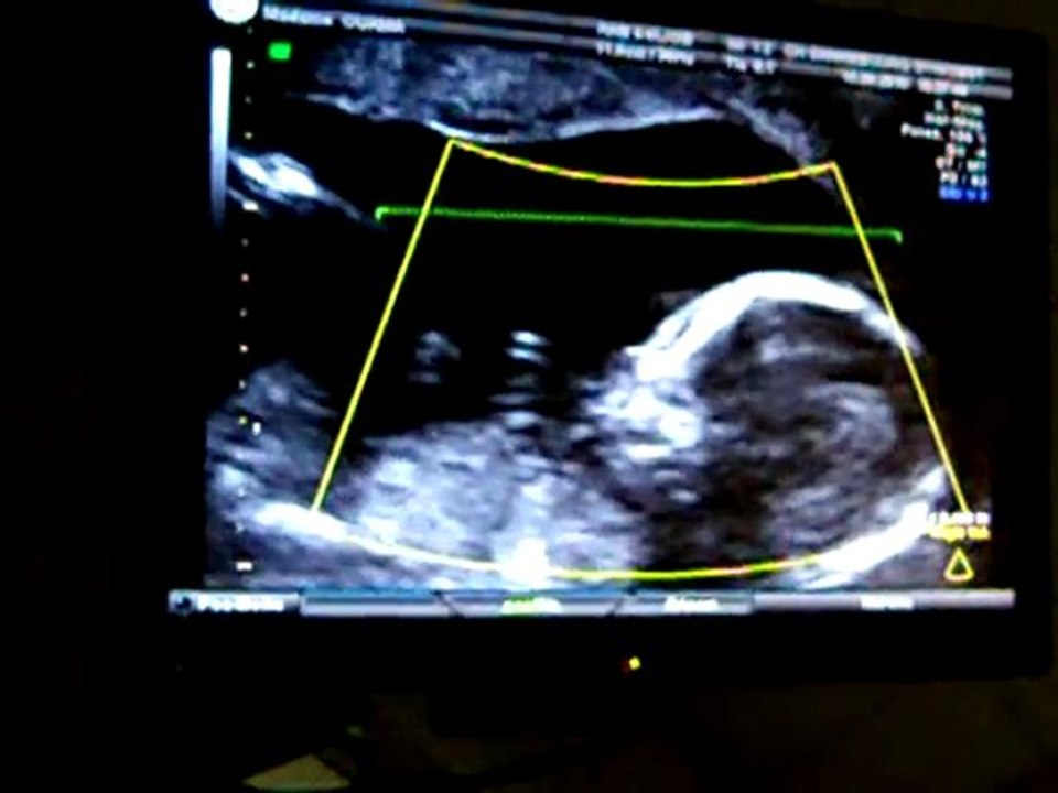 ana  ana jawad  hada  howa  bebe