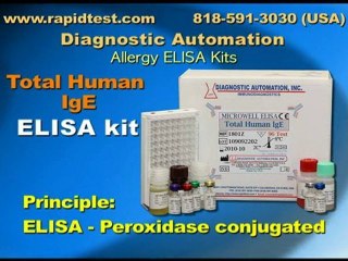 Total Human IgE ELISA Kit