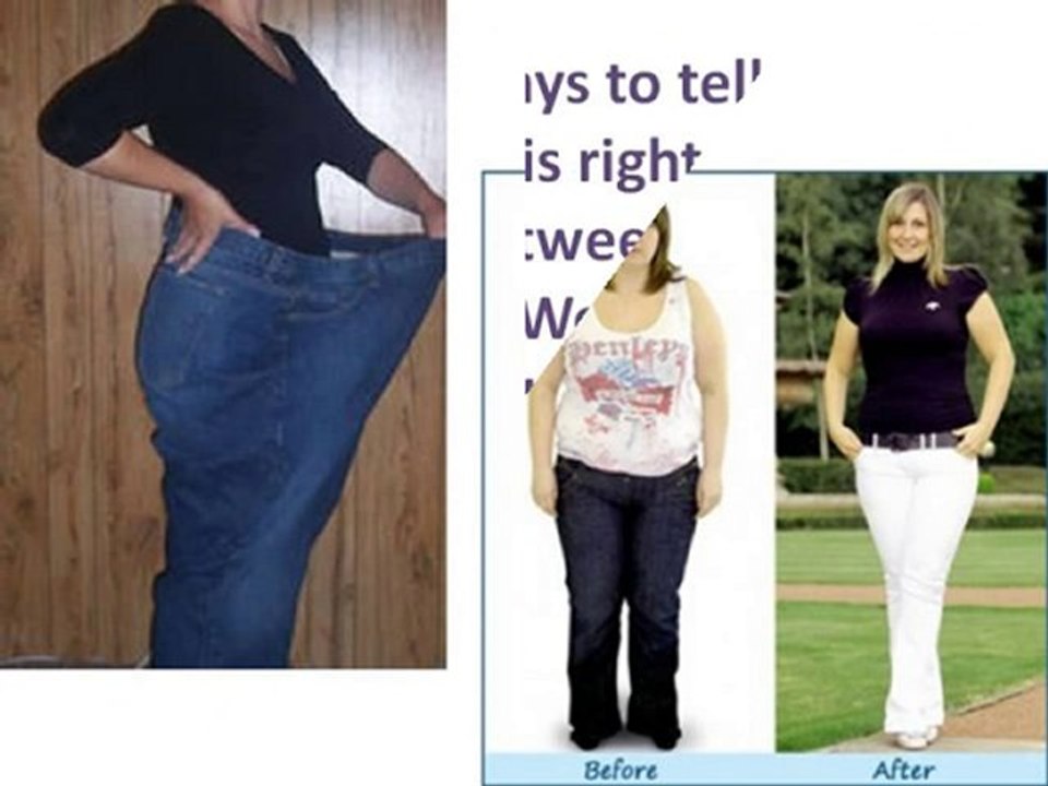 Lap Band Surgery Dallas-Dallas Lap Band Surgery