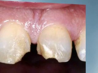Austin Dental Implants and Cosmetic Dentistry
