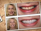 Teeth Whitening Woodland Hills Dentist