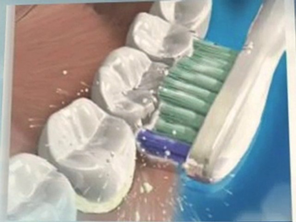 Sonicare Flexcare