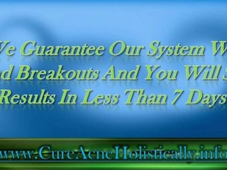 Cure Acne Holistically