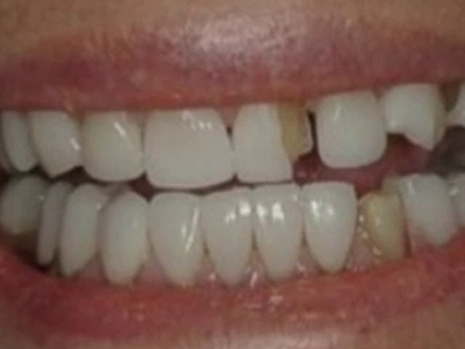 See an Oxford Dentist rather than going abroad for dental c