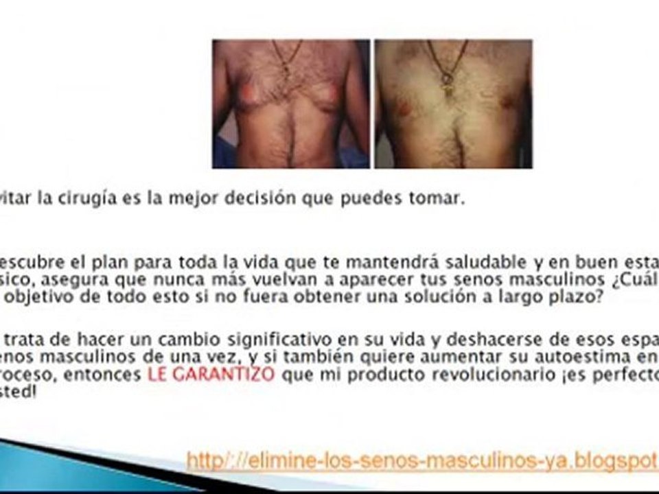 Elimine los Senos Masculinos - Ginecomastia -Grasa del Pecho