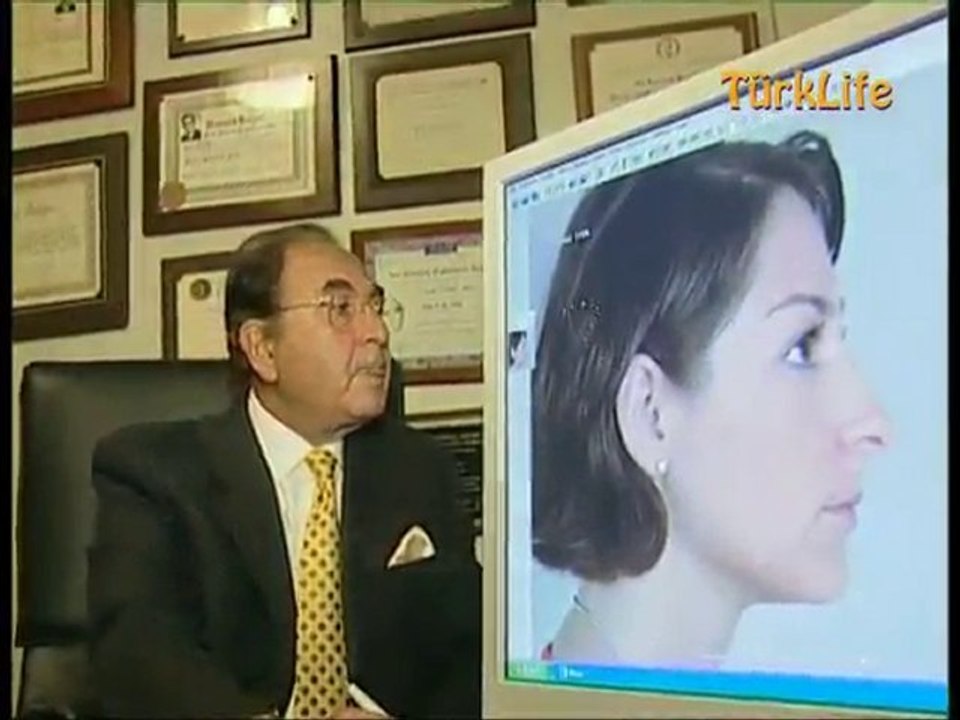 Prof.Dr. Onur Erol  canlı Kepçe Kulak Ameliyatı