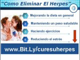 Como eliminar el Herpes- Tratamientos Para El Herpes