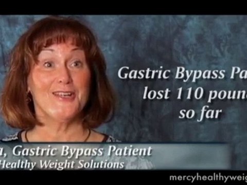 Gastric Bypass – Bariatric Surgeon in Cincinnati, Ohio
