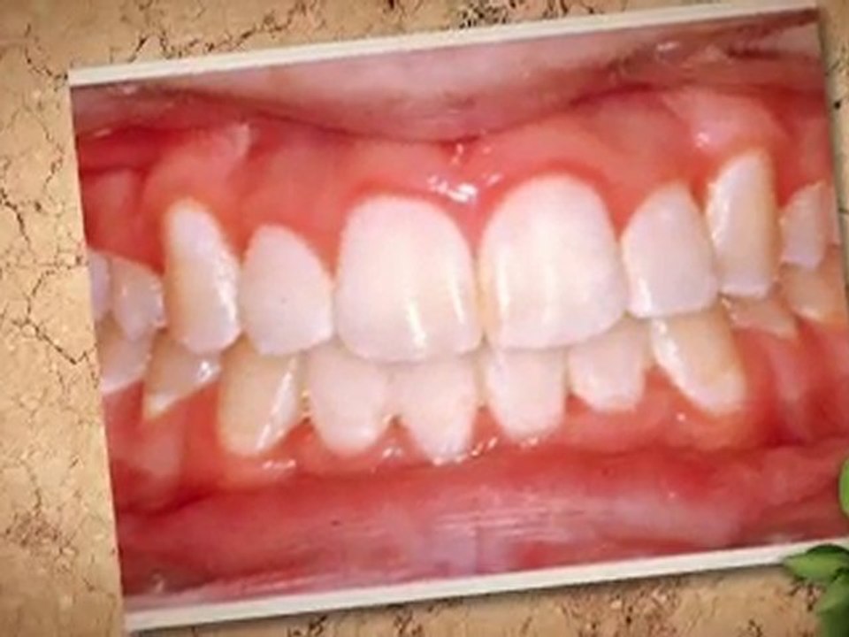 Westminster Orthodontist